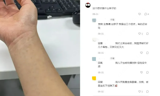 暴雨后要警惕！中招后会引起剧烈疼痛