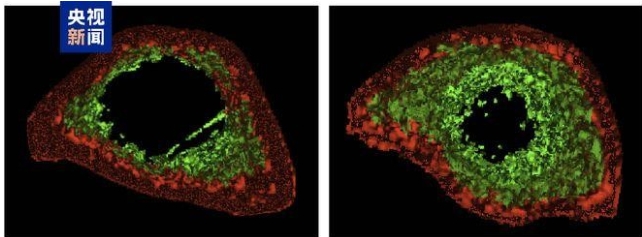 中國科學家成功構建“抗衰老細胞”